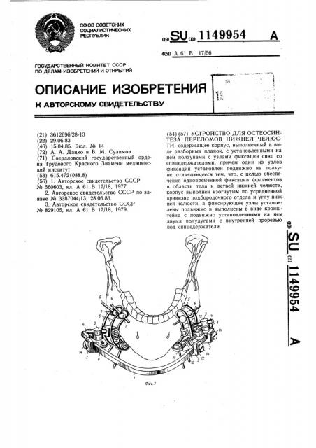 Устройство для остеосинтеза переломов нижней челюсти (патент 1149954)