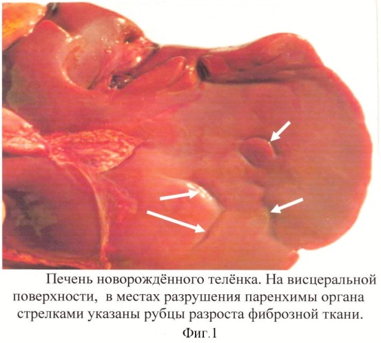 Способ патолого-морфологической диагностики токсической гепатодистрофии эмбрионального происхождения у крупного рогатого скота и свиней (патент 2354332)