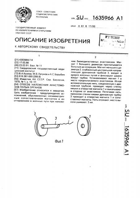 Способ наложения анастомозов полых органов (патент 1635966)