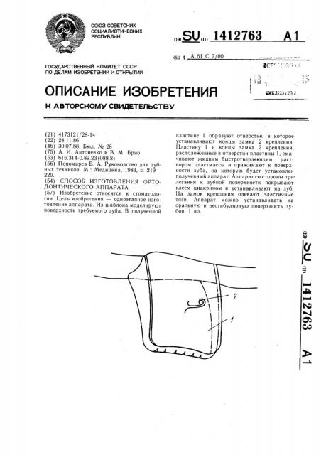 Способ изготовления ортодонтического аппарата (патент 1412763)