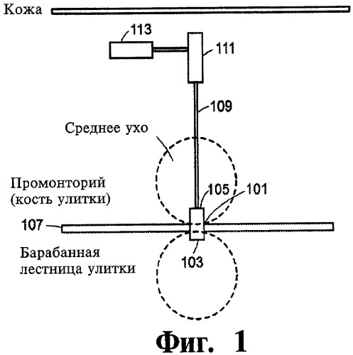 Имплантируемое устройство и способ доставки текучего лекарственного препарата в ткань (патент 2423154)