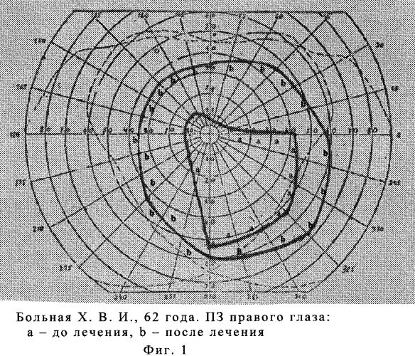 Способ терапевтического лечения первичной открытоугольной глаукомы (патент 2244528)