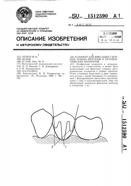 Кламмер для фиксации съемных зубных протезов и ортодонтических аппаратов (патент 1512590)