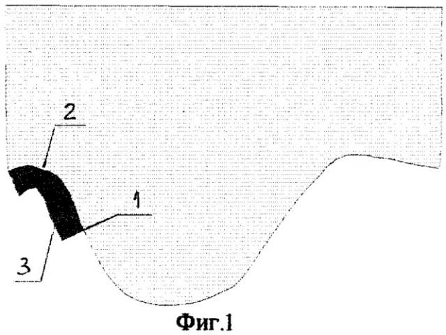 Способ формирования наружного края индивидуальной ложки для функциональных оттисков при полной потере зубов (патент 2271770)