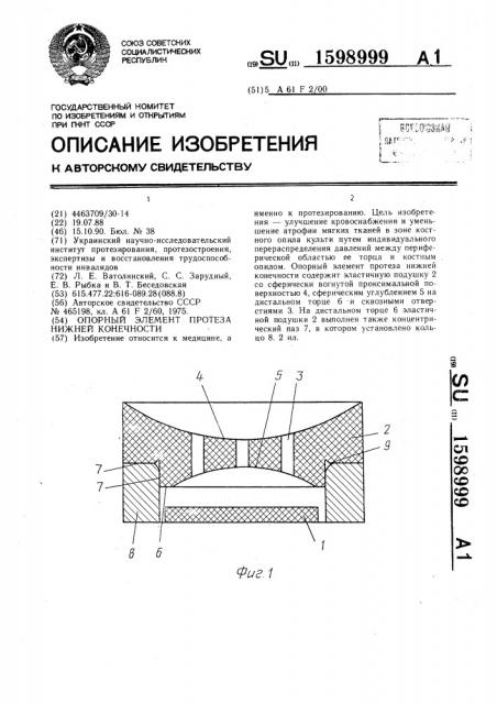 Опорный элемент протеза нижней конечности (патент 1598999)