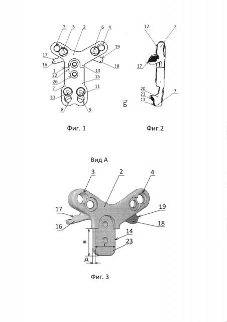 Устройство для передней стабилизации с1-с4 позвонков (патент 2652740)