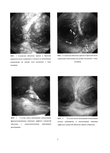Способ эндоскопического лечения острых термохимических повреждений слизистой оболочки трахеи и/или бронхов (патент 2591544)
