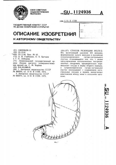 Способ резекции желудка (патент 1124936)