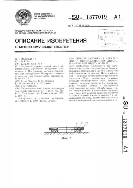 Способ наложения электродов с использованием двустороннего клеящего кольца (патент 1377019)