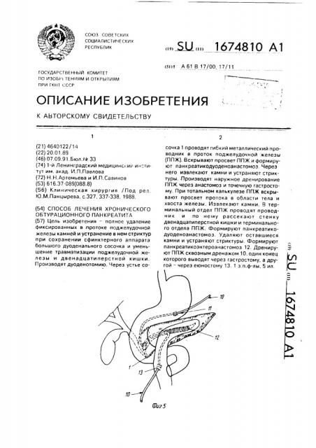 Способ лечения хронического обтурационного панкреотита (патент 1674810)