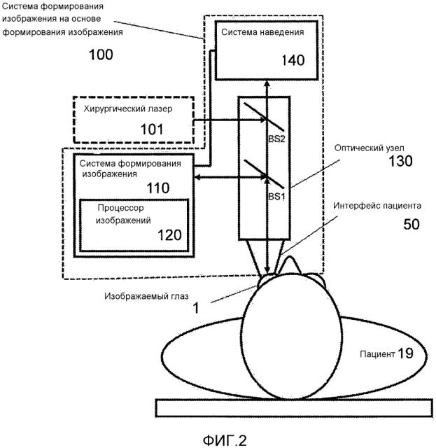 Система наведения на основе формирования изображения для офтальмологического позиционирования с использованием анализа положения и ориентации (патент 2608428)