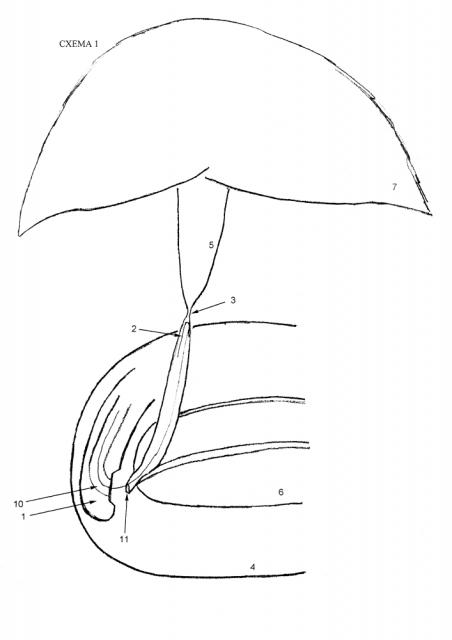 Способ эндоскопического бужирования рубцовых стриктур холедоха с применением перорального холедохоскопа (патент 2618207)