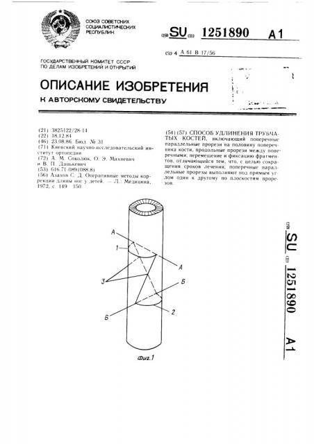 Способ удлинения трубчатых костей (патент 1251890)