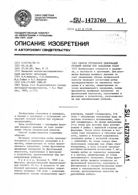 Способ устранения деформаций грудной клетки при западении ребер (патент 1473760)