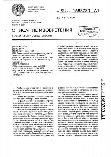 Способ нанесения декоративного покрытия на основу зубного протеза (патент 1683733)