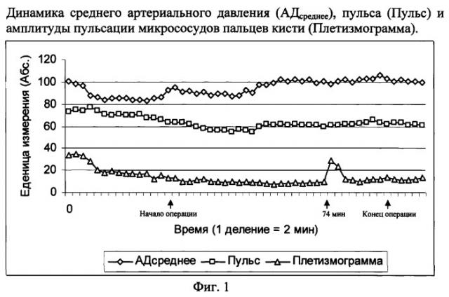 Способ эпидуральной анестезии на поясничном уровне позвоночника (патент 2309773)