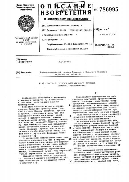 Способ э.г.топки оперативного лечения брюшного крипторхизма (патент 786995)