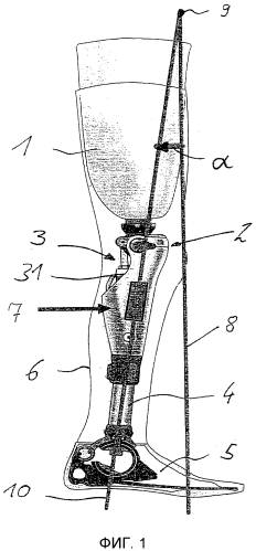 Способ управления искусственным ортезом или протезом коленного сустава (патент 2592248)