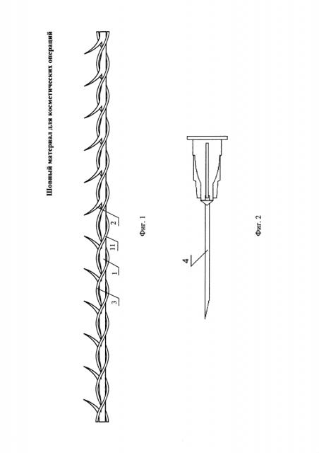 Шовный материал для косметических операций (патент 2611910)