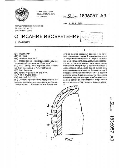 Зубной протез (патент 1836057)