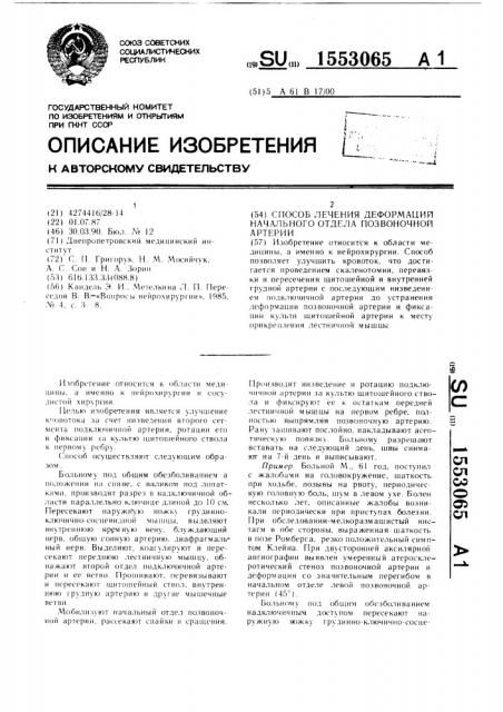 Способ лечения деформаций начального отдела позвоночной артерии (патент 1553065)