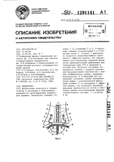 Эндопротез (патент 1291141)