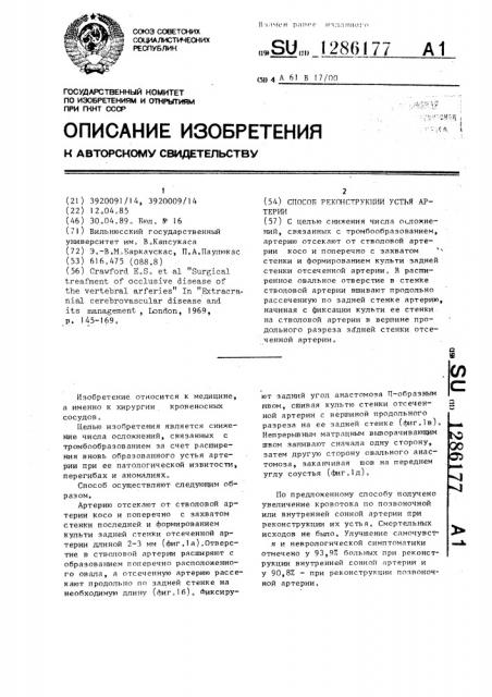 Способ реконструкции устья позвоночной артерии (патент 1286177)