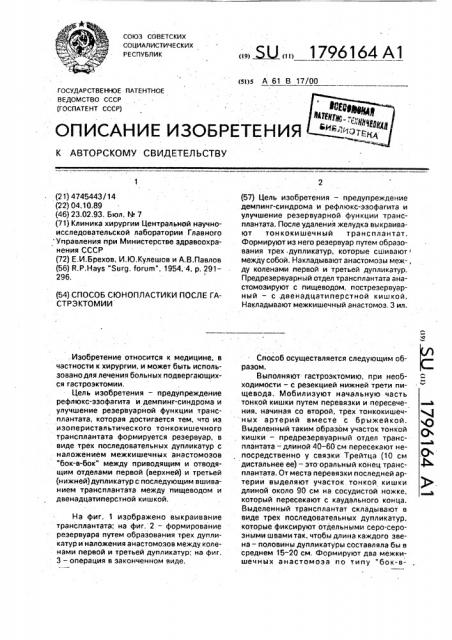 Способ еюнопластики после гастрэктомии (патент 1796164)