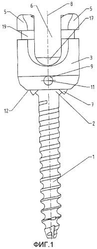 Спинальный шуруп (патент 2549017)