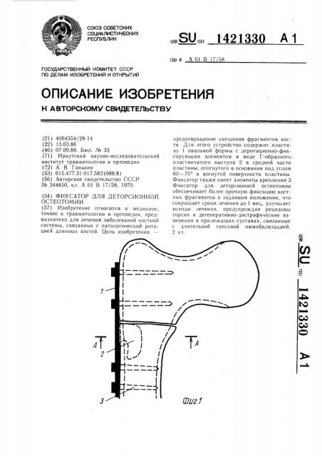 Фиксатор для деторсионной остеотомии (патент 1421330)