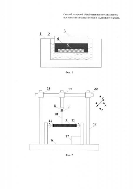 Способ лазерной обработки нанокомпозитного покрытия имплантанта связки коленного сустава (патент 2632114)