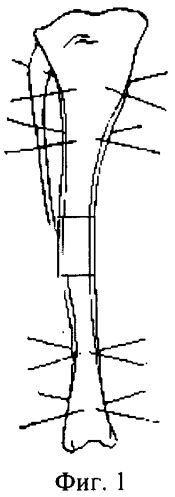 Способ моделирования замещения дефекта длинной трубчатой кости (патент 2281050)