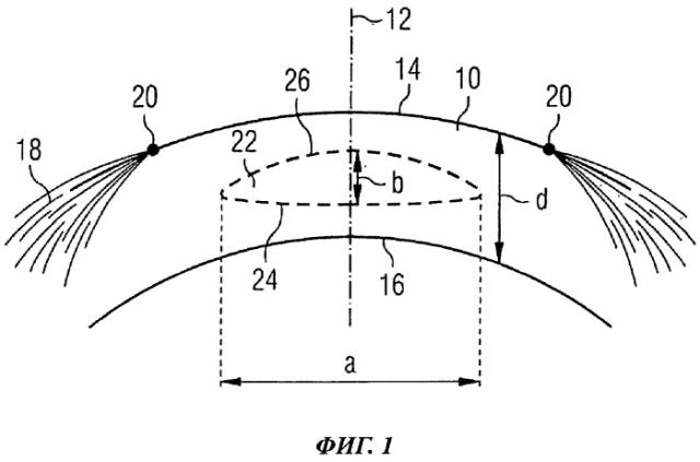 Устройство для лазерной хирургической офтальмологии (патент 2510259)