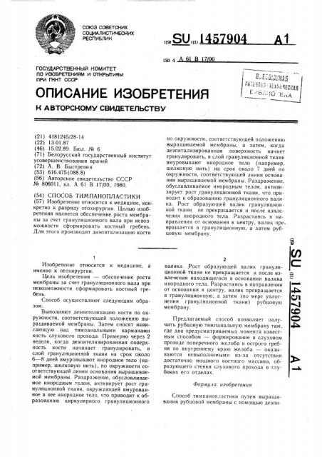 Способ тимпанопластики (патент 1457904)