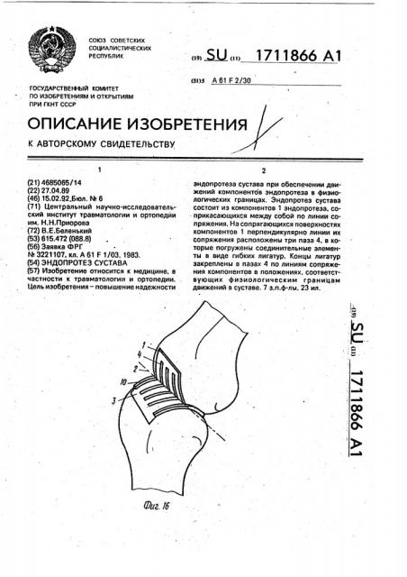 Эндопротез сустава (патент 1711866)
