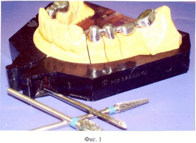 Способ изготовления металлокерамических зубных протезов (патент 2421182)