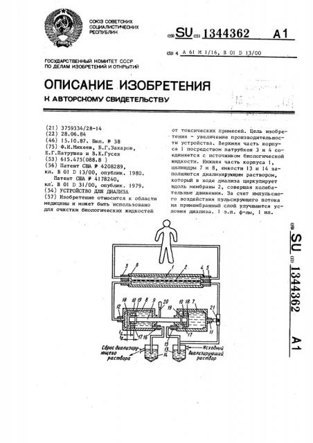 Устройство для диализа (патент 1344362)