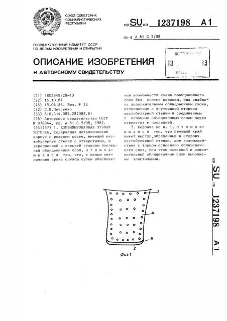 Комбинированная зубная коронка (патент 1237198)