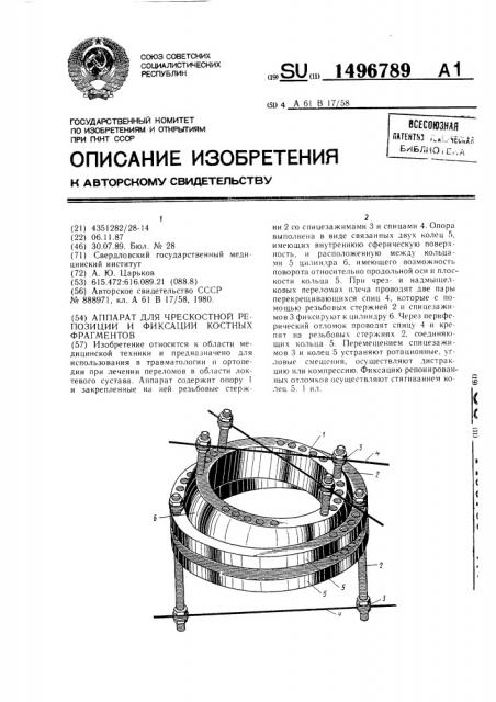 Аппарат для чрескостной репозиции и фиксации костных фрагментов (патент 1496789)