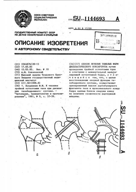 Способ лечения тяжелых форм диспластического коксартроза (патент 1144693)