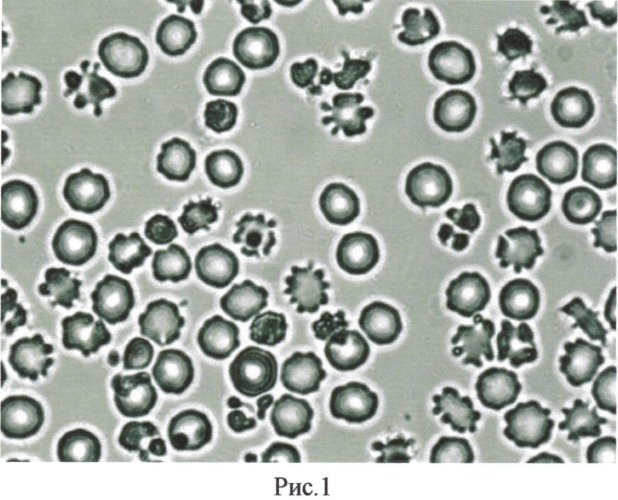 Способ оценки состояния цитоскелета эритроцитов (патент 2572335)