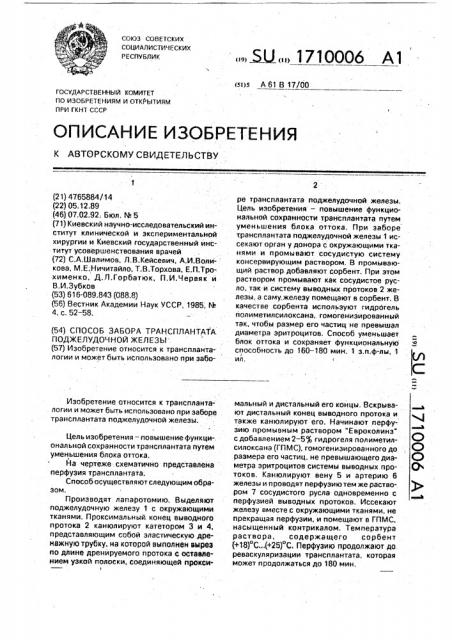 Способ забора трансплантата поджелудочной железы (патент 1710006)