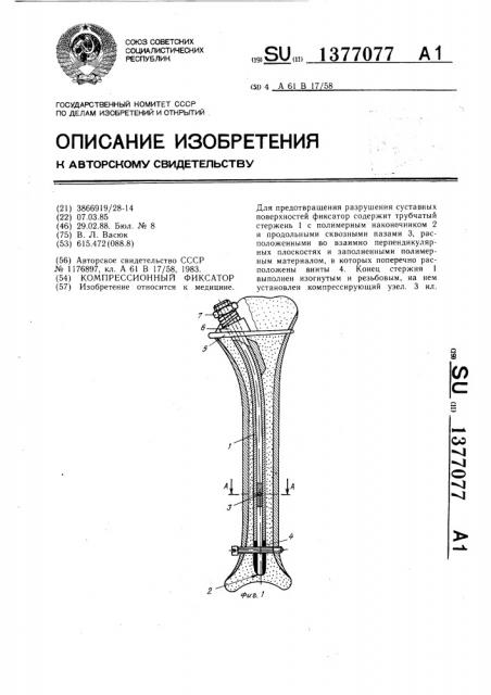 Компрессионный фиксатор (патент 1377077)