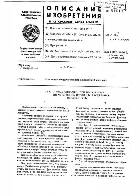 Способ операции при вражденных двухсторонних неполных расщелинах верхней губы (патент 619177)