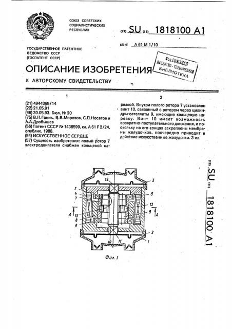 Искусственное сердце (патент 1818100)