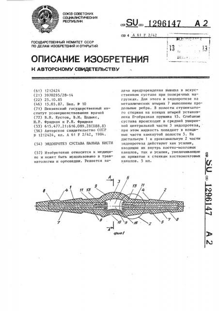Эндопротез сустава пальца кисти (патент 1296147)