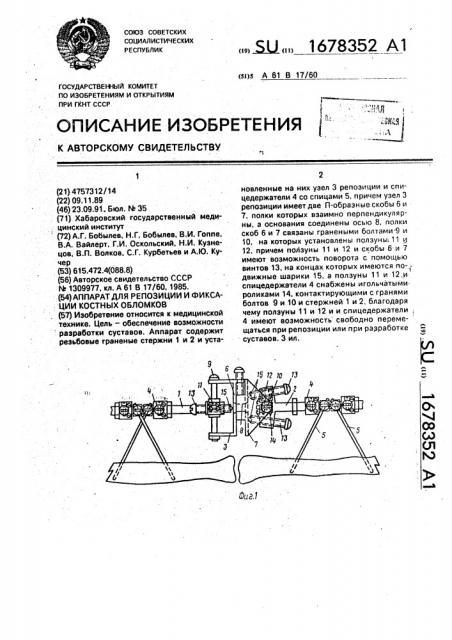 Аппарат для репозиции и фиксации костных обломков (патент 1678352)