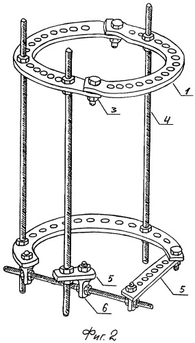 Устройство для дистракционного остеосинтеза лучезапястного сустава (патент 2299034)