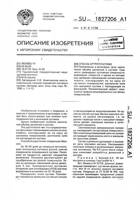 Способ артропластики (патент 1827206)