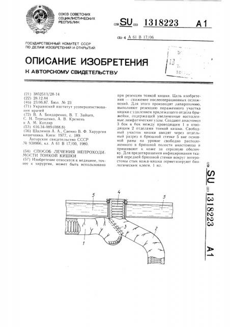 Способ лечения непроходимости тонкой кишки (патент 1318223)